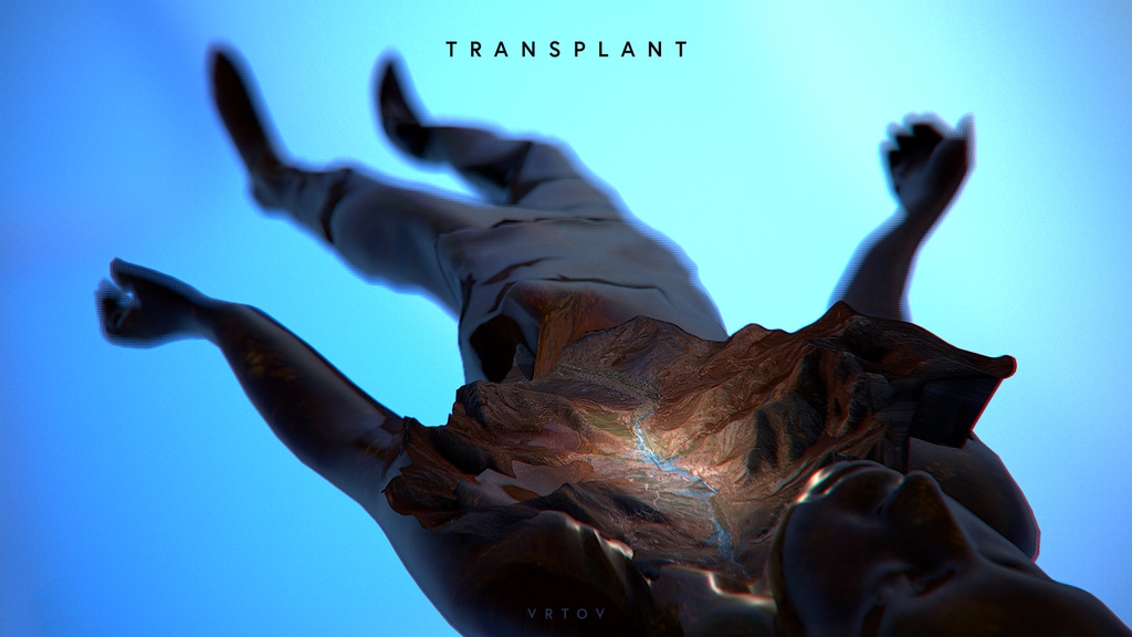 Photo: Transplant